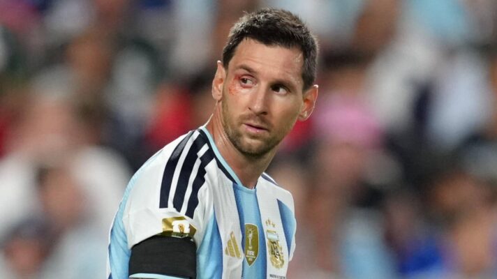 Lionel Messi suffered an eye injury against Switzerland